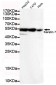 Keratin 7 (C-terminus) Antibody